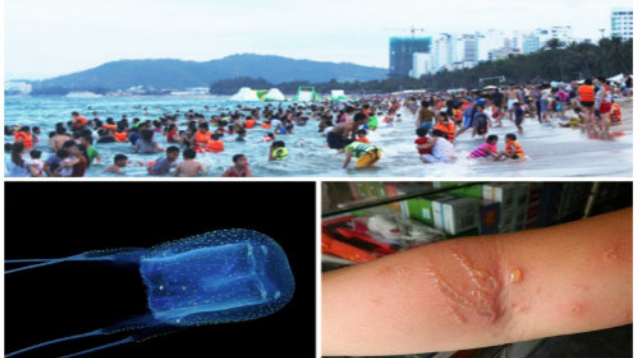 Nhiều khách du lịch có thể bị sứa đốt khi tắm biển